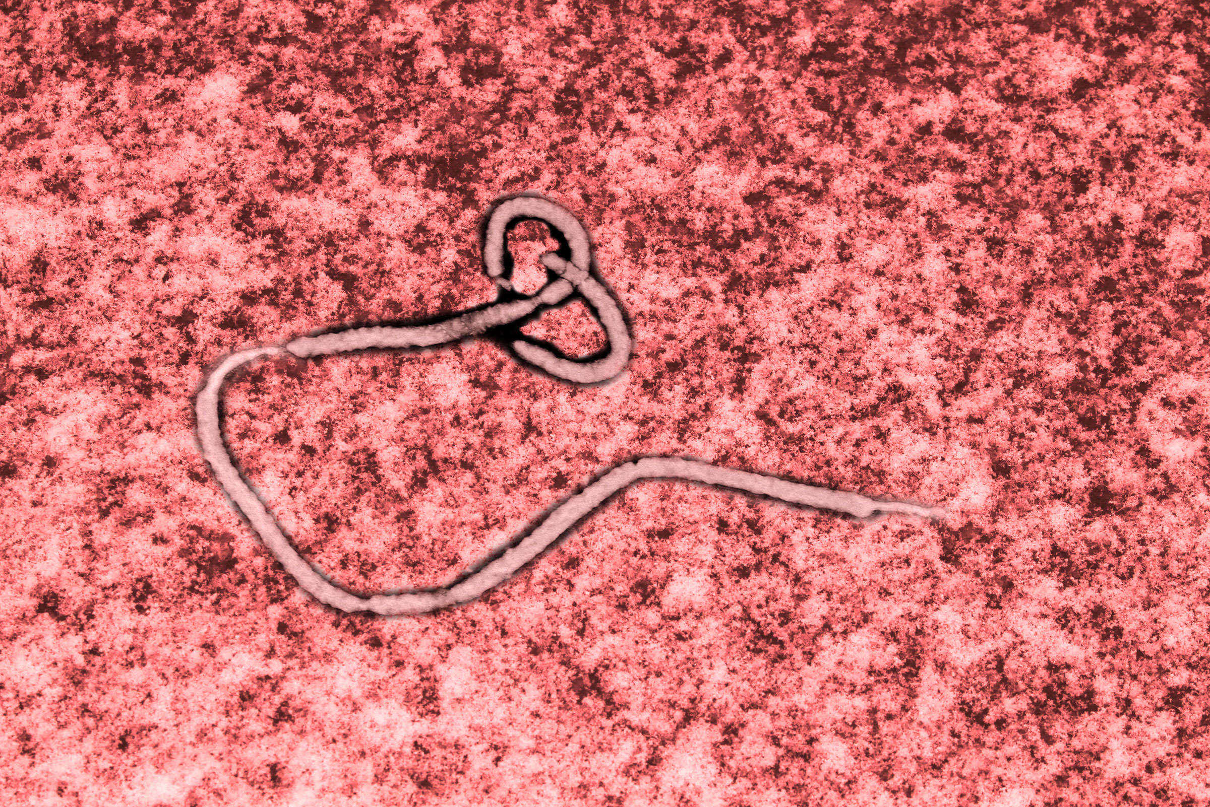 Ebola Virus under a microscope 