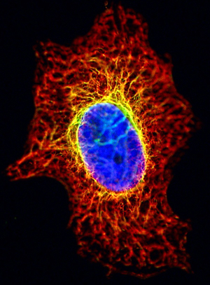 A microscopy image of a single cell. The center is a blue oval, and leading out from it and along behind it are thin filaments forming a complex mesh. The filaments around and reaching out from the center are yellow closest to the center and red going further out, resembling flames. Within the center a few strands can be seen as if they are behind colored glass, few green strands and fine red strands along the edge. 