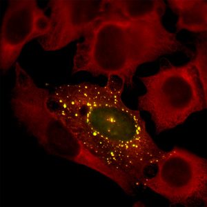 A microscopy image of cells, stained a glowing red, with irregular edges and a distinct center compartment with less red. One cell, in the center, has scattered bright yellow dots, and the center has diffuse green and just a few yellow dots.