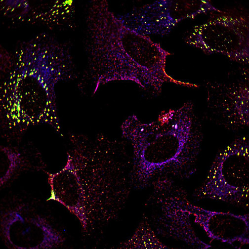 microscopy image of cells with blue, yellow and red staining; the blue is mostly diffuse but the yellow and red are mostly points