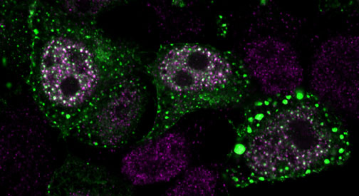 A microscopy image of cells, labeled with purple and green fluorescence. There are several roughly oval clusters of small dots of purple, around some of them is a region with green dots, some of which are larger, looking like drops of color.