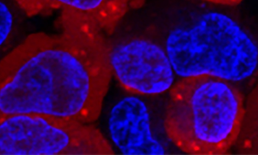 microscopy image of cells: bright blue blobs, some inside larger red blobs