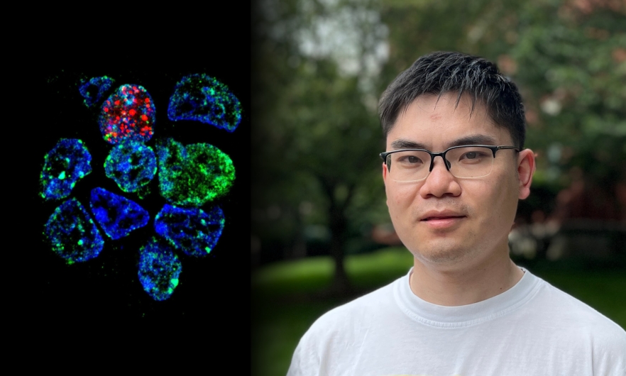 Right: Yang Liu, Left: cluster of cells stained blue with fluorescent green and red splotches on a black background