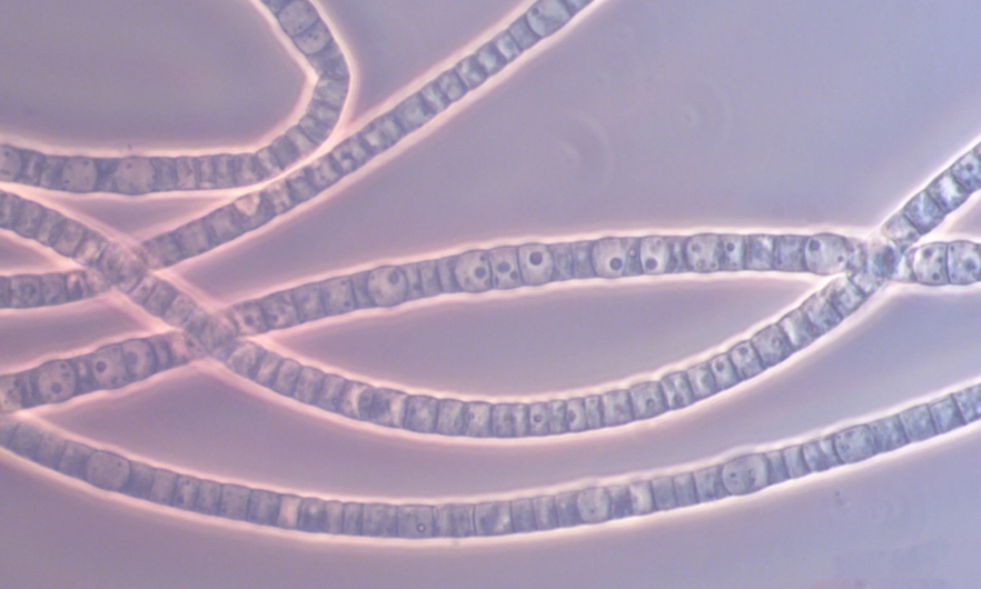 microscopic image of cable bacteria