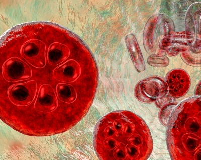 A group of malaria-infected red blood cells.