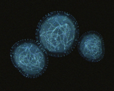 Monkeypox cells