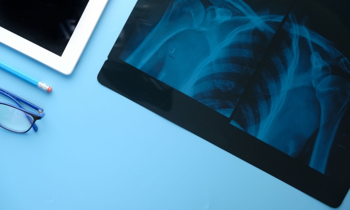 An x-ray of a human upper body skeleton on an tablet.