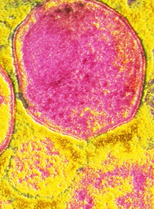 neglected disease under a microscope