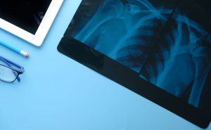 An x-ray of a human upper body skeleton on an tablet.