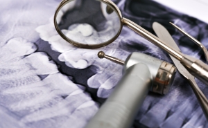 Stock photo of dentist tools on top of xray of teeth