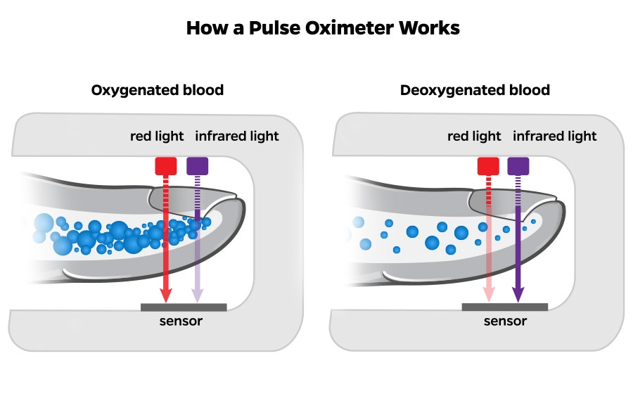 Pulse Oximeters’ Racial Bias | Johns Hopkins | Bloomberg School Of ...