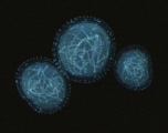 Microscope image of the monkeypox virus