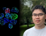 Right: Yang Liu, Left: cluster of cells stained blue with fluorescent green and red splotches on a black background