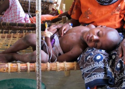 A child is treated for dehydration due to cholera during an outbreak in Zanzibar.