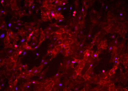 A field of red-stained cells with blue spots near the centers