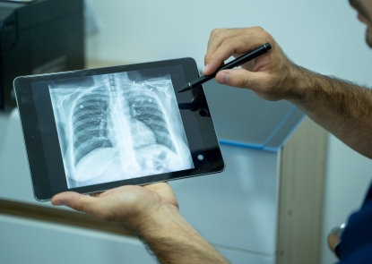 Doctor explaining the results of scan lung on digital tablet